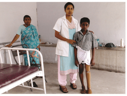 An artificial leg is provided